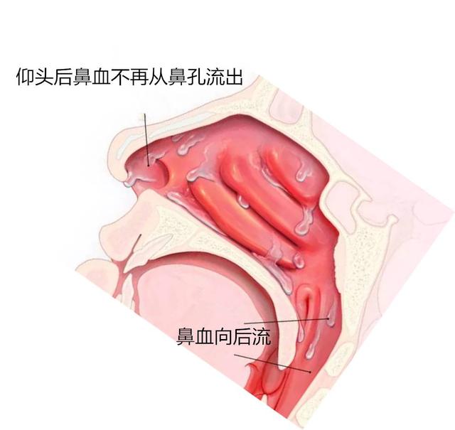 家庭急救指南，小孩烫伤处理步骤