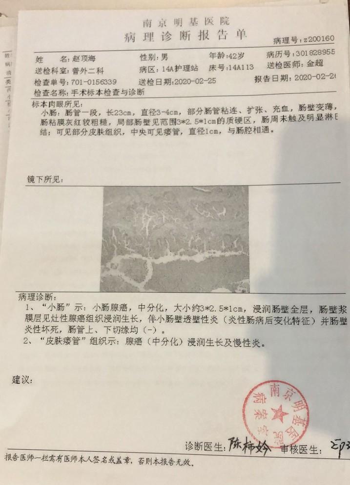 十六岁之痛，哥哥与弟弟的抗癌之旅